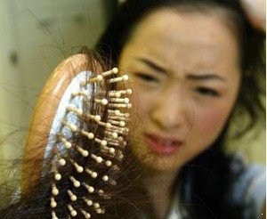 脱发